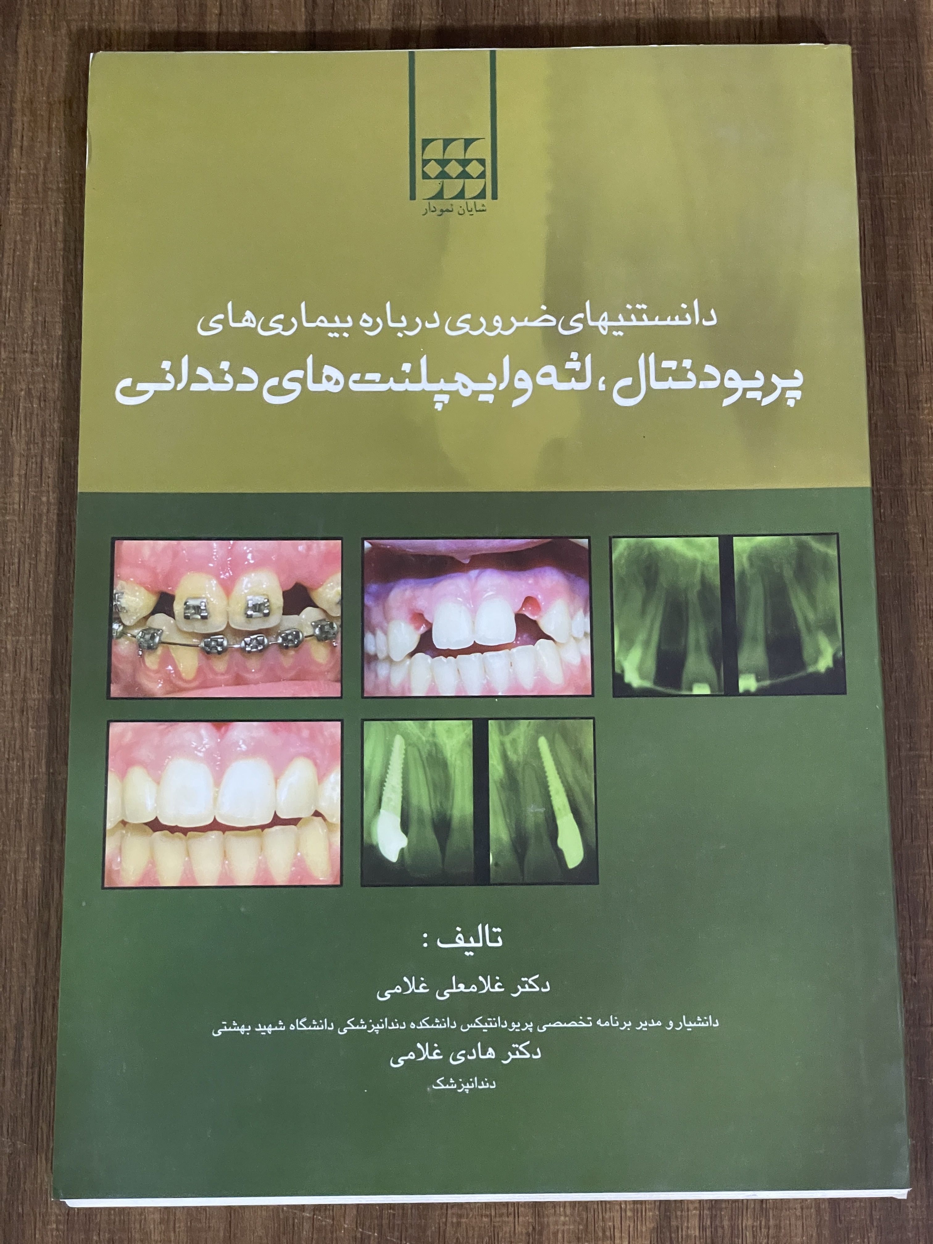 کتاب دانستنیهای ضروری درباره بیماری های پریودنتال لثه و ایمپلنت های دندانی - دست دوم
